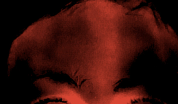 Infrared image of the forehead and prefrontal cortex after neurofeedback session 3, brighter and more even